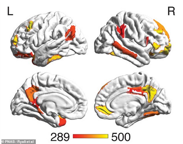 This image from the new study shows which parts of the brain are most important in distinguishing between men and women: the striatum, and areas involved in the default mode network and limbic network